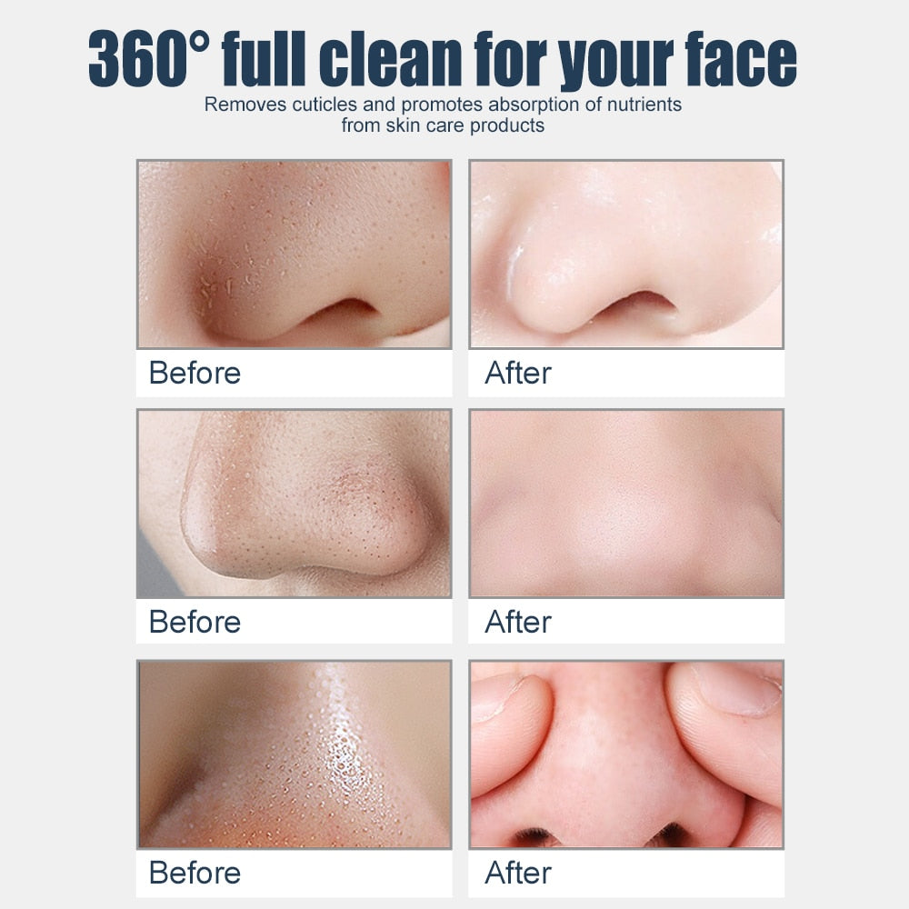 JVR Blackhead Remover Mask - Bamboo Charcoal Cleansing Mask
